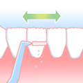 歯と歯の隙間に