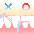 歯間ブラシの角度