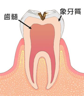 歯の内部構造